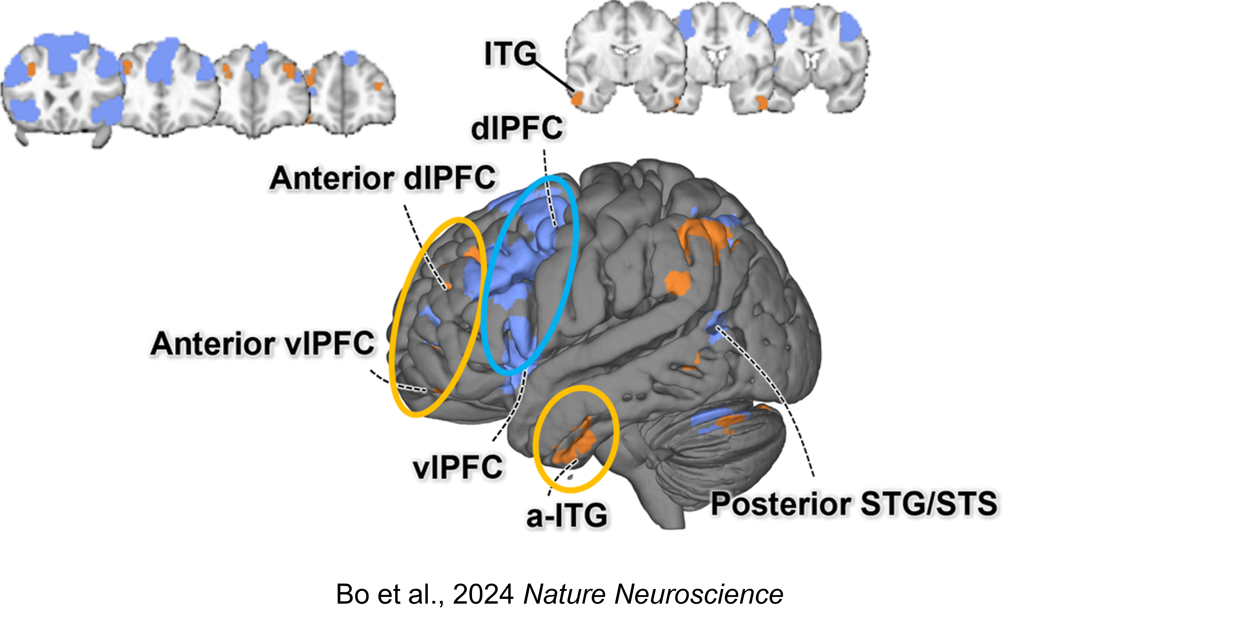 Brain maps showing prefrontal and temporal systems involved in emotion regulation, including anterior dlPFC, anterior vlPFC, dlPFC, vlPFC, anterior inferior temporal gyrus, and posterior STG/STS